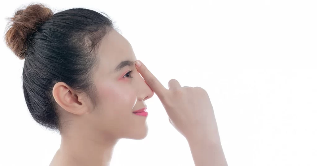 Apa Itu Filler Hidung? Persiapan, Prosedur, Efek Samping
