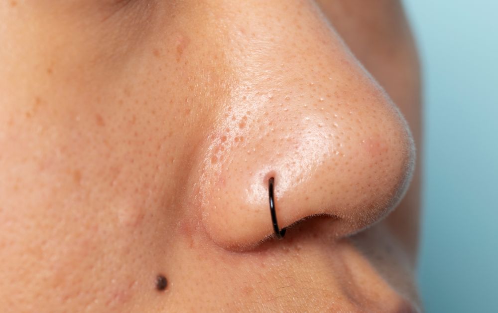 Penyebab Dan Cara Mengecilkan Pori Pori Besar Di Hidung