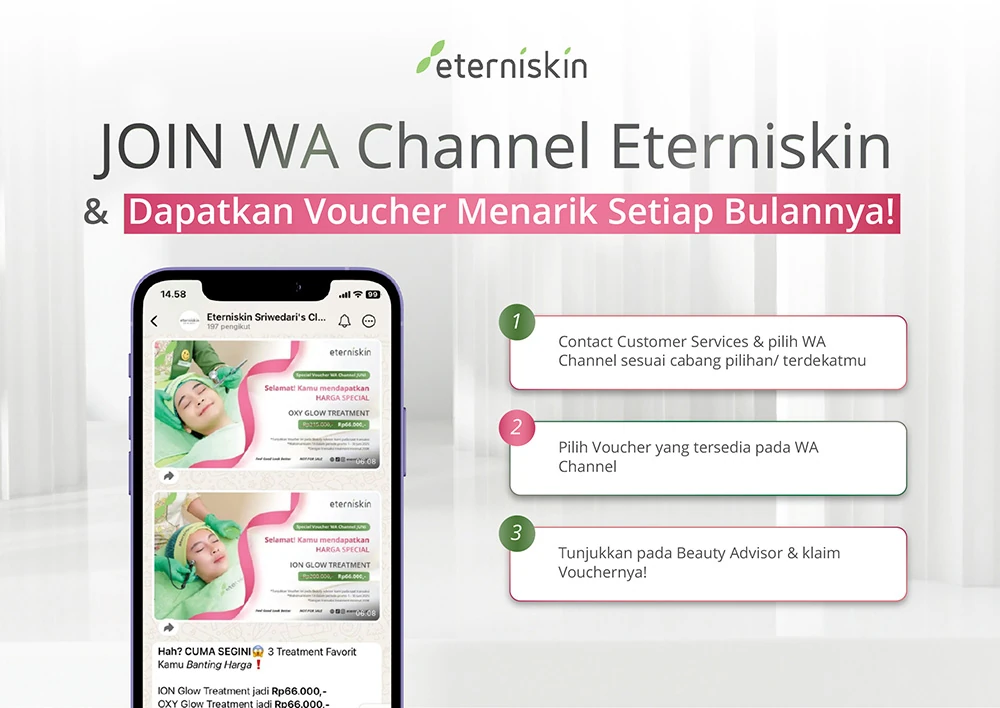 Promo Eterniskin - Join WA Channel
