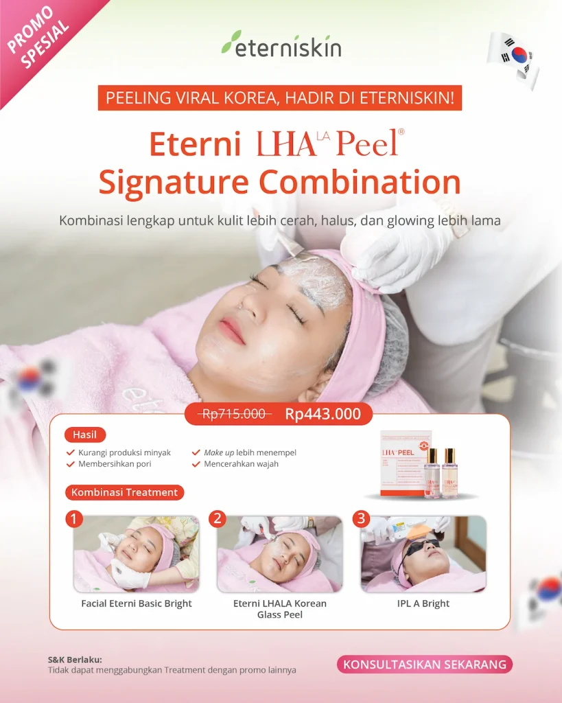 Promo Eterni Lhala Peel Signature Combination 2026 - 01