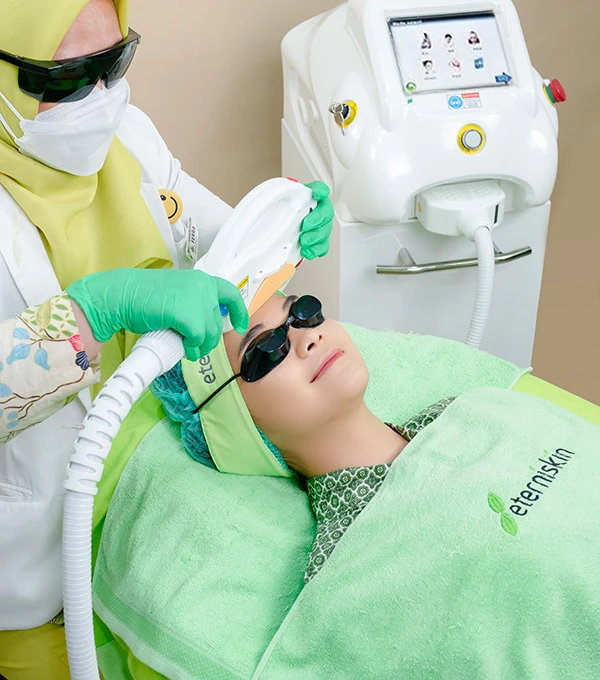 Treatment IPL Acne Whitening untuk Hempaskan Jerawat dan Kulit Kusam