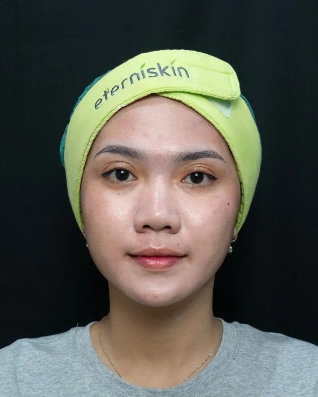 eterniskin-eterni-exosome-light-booster-after