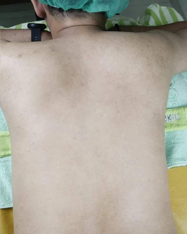 eterniskin-eterni-glow-peel-body-after