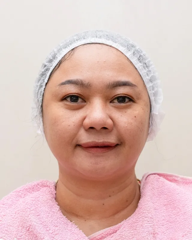 eterniskin-eterni-lhala-korean-glass-peel-after