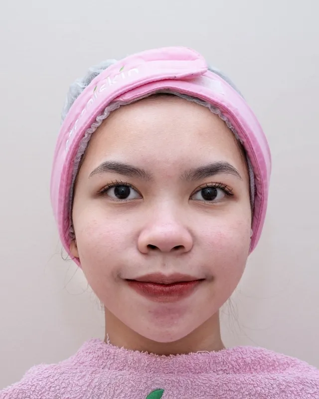 eterniskin-facial-eterni-dermapro-after