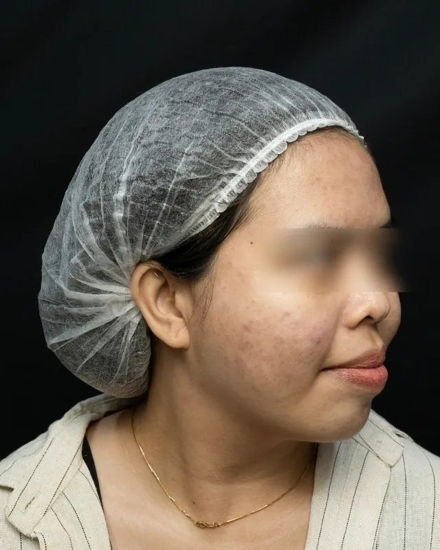 eterniskin-facial-eterni-oxy-after