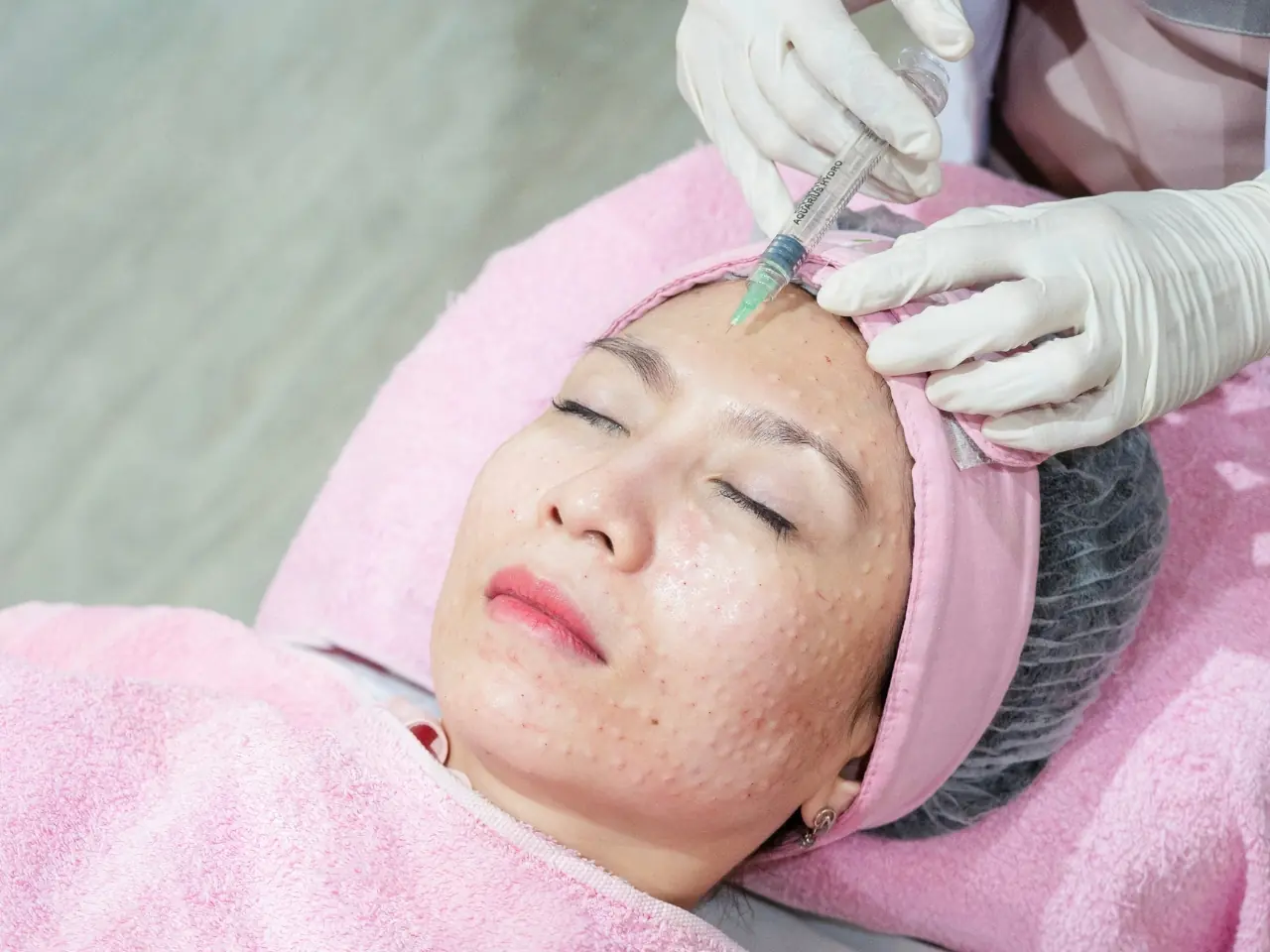 eterniskin-skin-booster-injeksi-hidrasi