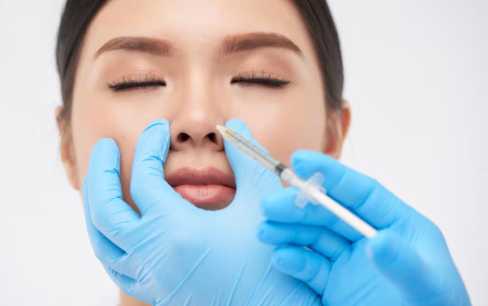 tindakan filler hidung