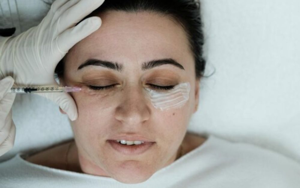 manfaat filler pada kantung mata