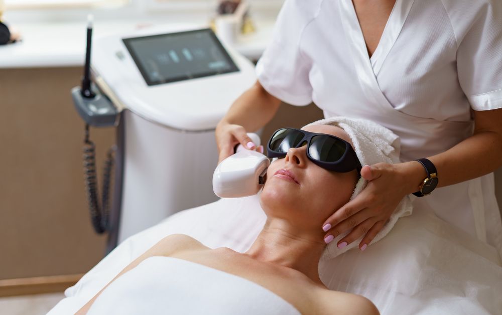 Kelebihan IPL Treatment untuk Kulit Berjerawat