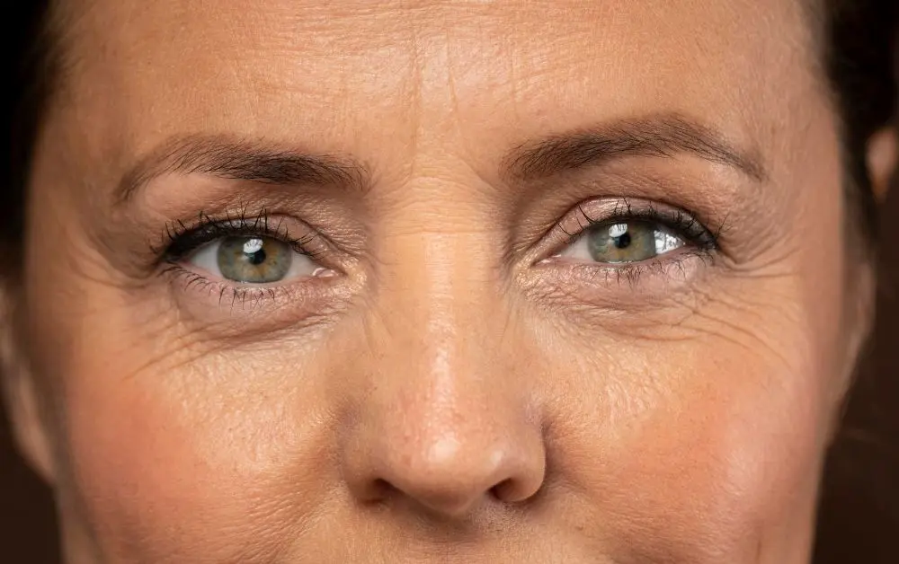Penyebab dan Cara Menghilangkan Kerutan di Bawah Mata