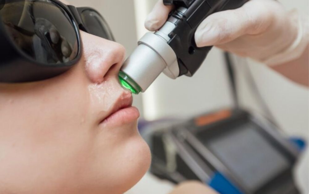 Pico Lip Laser: Hasil Bibir Lebih Merona Tanpa Lipstik, Bisa Gak?