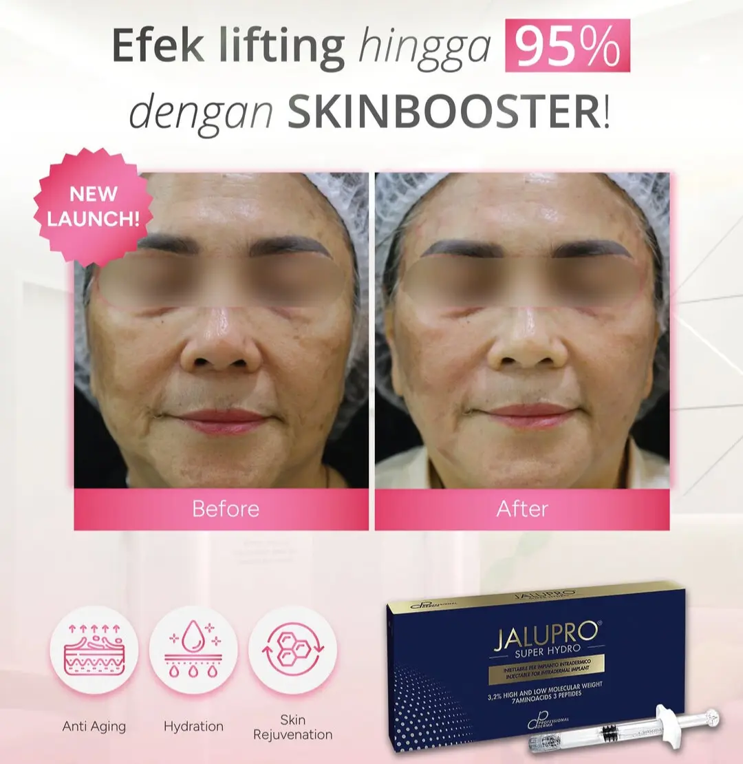 Face Lifting Modern: Skinbooster Jalupro Super Hydro di Eterniskin