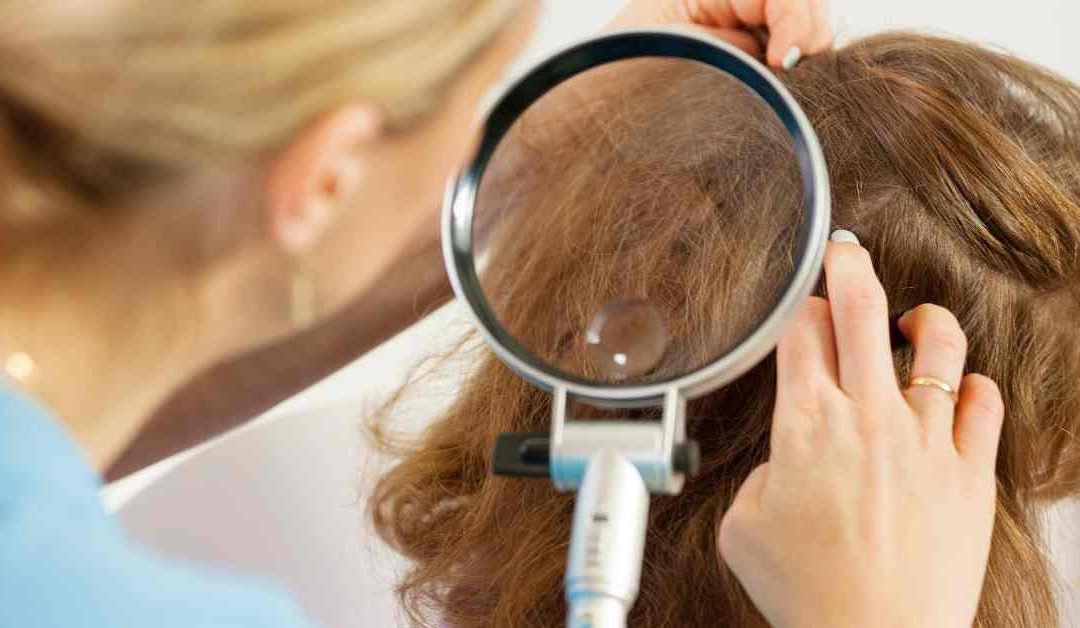 Bagaimana Cara Menghilangkan Kutu Rambut Terefektif?